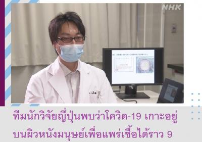 ทีมนักวิจัยญี่ปุ่นพบว่าโควิด-19 เกาะอยู่บนผิวหนังมนุษย์เพื่อแพร่เชื้อได้ราว 9 ชั่วโมง