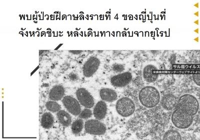 พบผู้ป่วยฝีดาษลิงรายที่ 4 ของญี่ปุ่นที่จังหวัดชิบะ หลังเดินทางกลับจากยุโรป