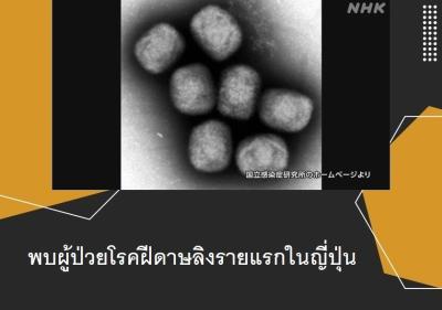 พบผู้ป่วยโรคฝีดาษลิงรายแรกในญี่ปุ่น