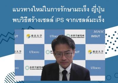 แนวทางใหม่ในการรักษามะเร็ง ญี่ปุ่นพบวิธีสร้างเซลล์ iPS จากเซลล์มะเร็ง