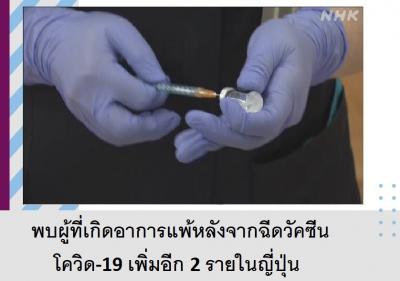 พบผู้ที่เกิดอาการแพ้หลังจากฉีดวัคซีนโควิด-19 เพิ่มอีก 2 รายในญี่ปุ่น